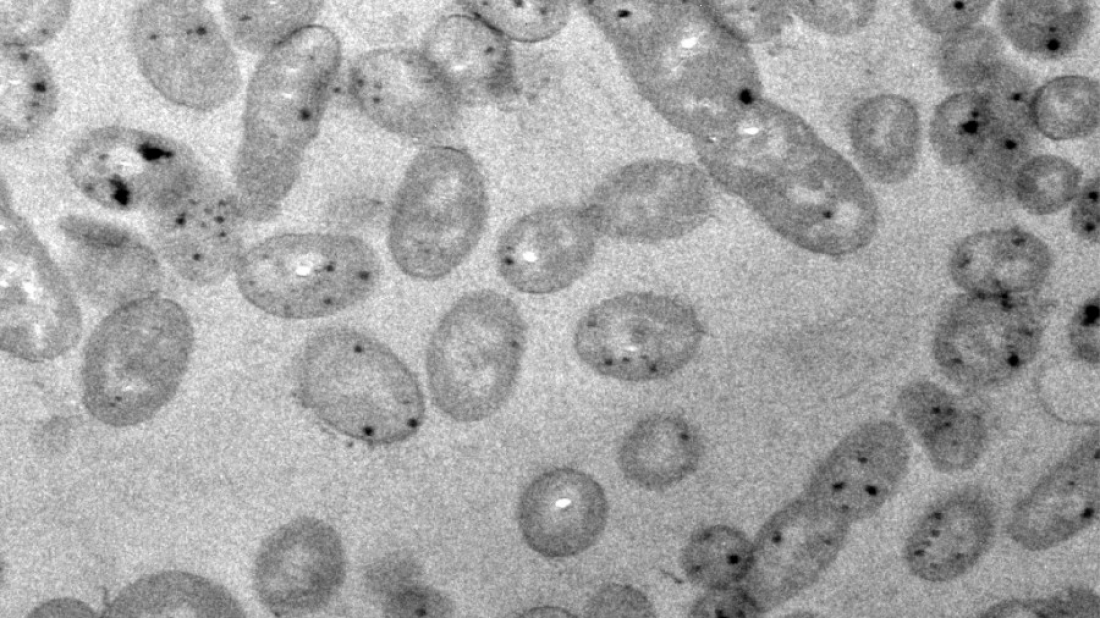 Imatge del bacteri Alteromonas mediterranea ISS312 creixent en un medi amb metilmercuri obtinguda per microscòpia electrònica de transmissió / ICM-CSIC i UAB 
