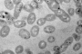 Imatge del bacteri Alteromonas mediterranea ISS312 creixent en un medi amb metilmercuri obtinguda per microscòpia electrònica de transmissió / ICM-CSIC i UAB 